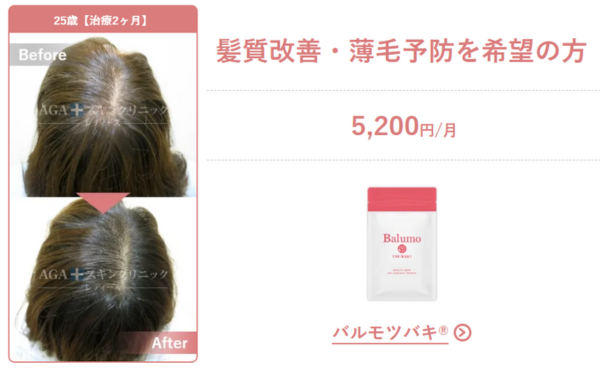 AGAスキンクリニック銀座院レディースの女性の薄毛治療症例や髪質改善・薄毛予防