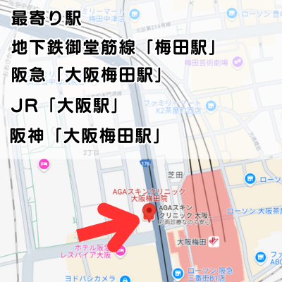 AGAスキンクリニック大阪梅田院の地図と最寄り駅の説明