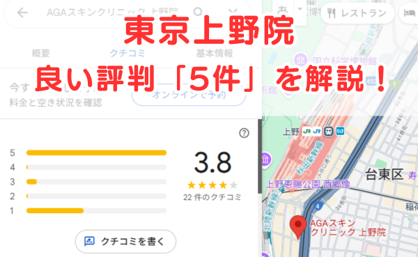AGAスキンクリニック東京上野院の良いレビュー評判5件を解説！
