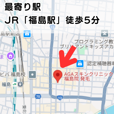 AGAスキンクリニック福島院の地図と最寄り駅の説明