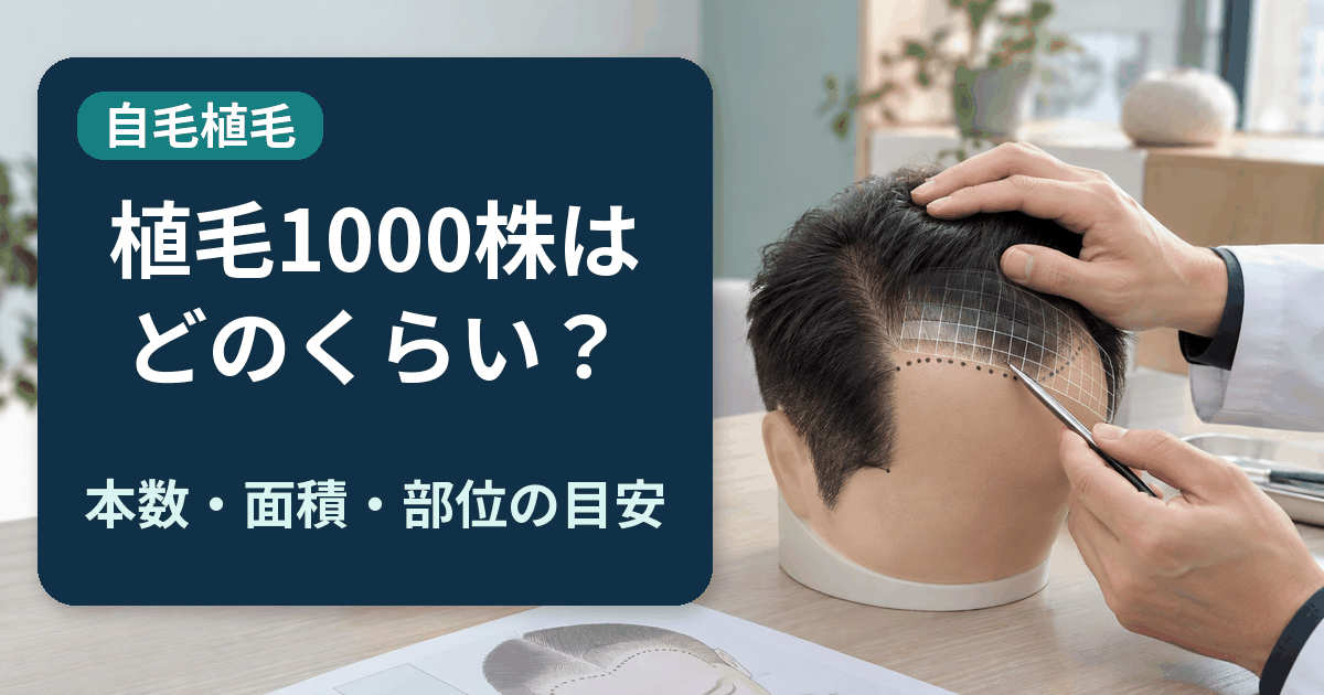 自毛植毛1000株の本数や面積を頭部模型で確認するイメージ